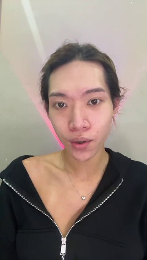 Acne-prone skin without makeup showing natural texture
